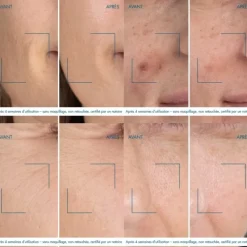 Soin De Nuit|Sérum Et Booster><noscript><img width=