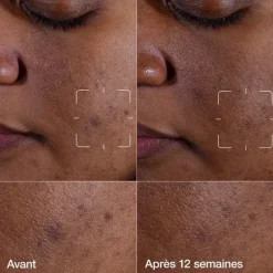 Soin Spécifique Visage|Soin Jour & Nuit><noscript><img width=