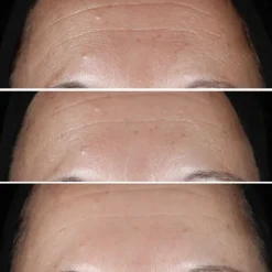 Sérum Et Booster><noscript><img width=