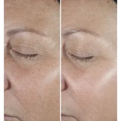 Sérum Et Booster><noscript><img width=