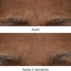 Soin Spécifique Visage|Soin Jour & Nuit><noscript><img width=