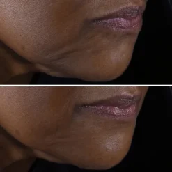 Soin Jour & Nuit><noscript><img width=