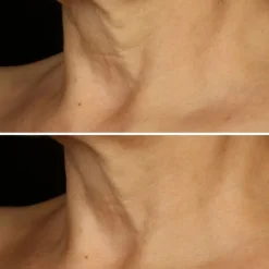 Soin Jour & Nuit><noscript><img width=