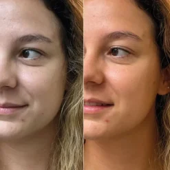 Sérum Et Booster|Soin Naturel & Ecoresponsable><noscript><img width=