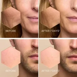 Sérum Et Booster><noscript><img width=