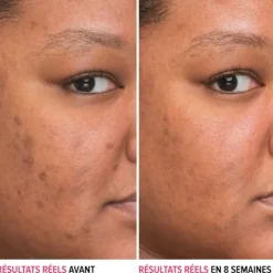 Soin Spécifique Visage|Sérum Et Booster><noscript><img width=