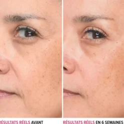 Sérum Et Booster|Soin Jour & Nuit><noscript><img width=