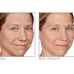 Soin De Nuit><noscript><img width=