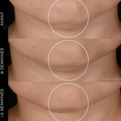 Soin Jour & Nuit|Soin Naturel & Ecoresponsable><noscript><img width=